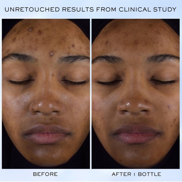 $13❤️🔥 Lancôme Clarifique Pro-Solution Brightening & Dark Spot Reducing Serum - Picture 6 of 12